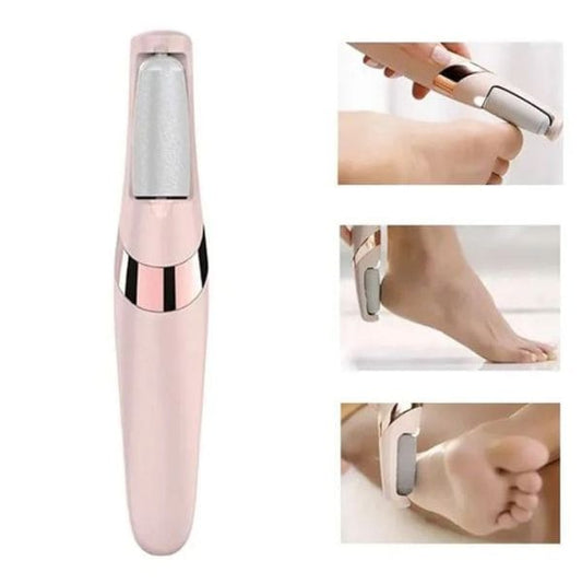Foot Callus Remover for Smooth Heels – Dead Skin Remover for Feet
