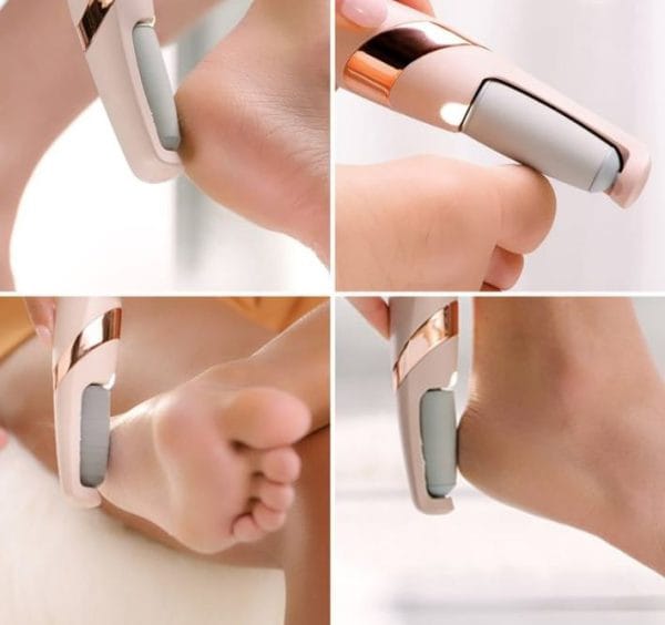 Foot Callus Remover for Smooth Heels – Dead Skin Remover for Feet